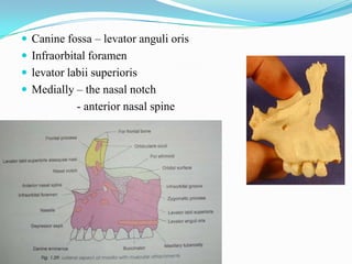 POSTERIOR / INFRATEMPORAL SURFACE
 Concave
 Directed – backward & laterally
 Forms – anterior wall of infratemporal
fos...
