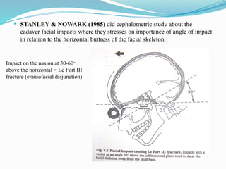  STANLEY & NOWARK (1985) did cephalometric study about the
cadaver facial impacts where they stresses on importance of angle of impact
in relation to the horizontal buttress of the facial skeleton.
Impact on the nasion at 30-60o
above the horizontal = Le Fort III
fracture (craniofacial disjunction)
 