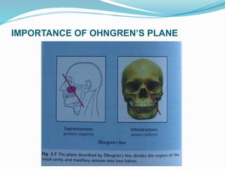 IMPORTANCE OF OHNGREN’S PLANE
 