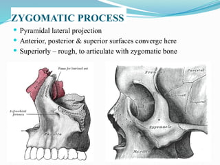  Pyramidal lateral projection
 Anterior, posterior & superior surfaces converge here
 Superiorly – rough, to articulate with zygomatic bone
ZYGOMATIC PROCESS
 
