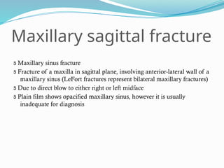 Maxillary sagittal fracture
 Maxillary sinus fracture
 Fracture of a maxilla in sagittal plane, involving anterior-lateral wall of a
maxillary sinus (LeFort fractures represent bilateral maxillary fractures)
 Due to direct blow to either right or left midface
 Plain film shows opacified maxillary sinus, however it is usually
inadequate for diagnosis
 