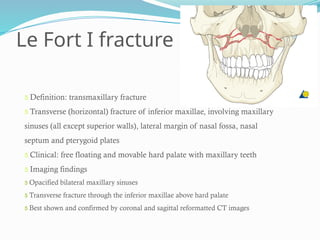 Le Fort I fracture
 Definition: transmaxillary fracture
 Transverse (horizontal) fracture of inferior maxillae, involving maxillary
sinuses (all except superior walls), lateral margin of nasal fossa, nasal
septum and pterygoid plates
 Clinical: free floating and movable hard palate with maxillary teeth
 Imaging findings
 Opacified bilateral maxillary sinuses
 Transverse fracture through the inferior maxillae above hard palate
 Best shown and confirmed by coronal and sagittal reformatted CT images
 