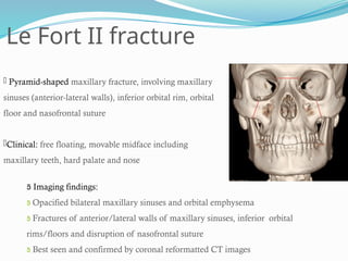 Le Fort II fracture
 Pyramid-shaped maxillary fracture, involving maxillary
sinuses (anterior-lateral walls), inferior orbital rim, orbital
floor and nasofrontal suture
Clinical: free floating, movable midface including
maxillary teeth, hard palate and nose
 Imaging findings:
 Opacified bilateral maxillary sinuses and orbital emphysema
 Fractures of anterior/lateral walls of maxillary sinuses, inferior orbital
rims/floors and disruption of nasofrontal suture
 Best seen and confirmed by coronal reformatted CT images
 
