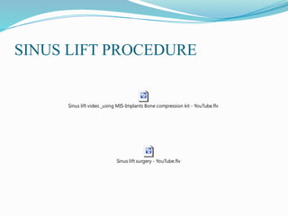 SINUS LIFT PROCEDURE
Sinus lift video _using MIS-Implants Bone compression kit - YouTube.flv
Sinus lift surgery - YouTube.flv
 