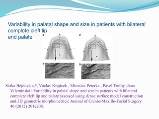 Variability in palatal shape and size in patients with bilateral
complete cleft lip
and palate
Sárka Bejdová a,*, Václav Krajícek , Miroslav Peterka , Pavel Trefný ,Jana
Velemínská ; Variability in palatal shape and size in patients with bilateral
complete cleft lip and palate assessed using dense surface model construction
and 3D geometric morphometrics; Journal of Cranio-Maxillo-Facial Surgery
40 (2012) 201e208.
 