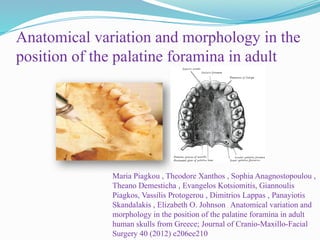 Anatomical variation and morphology in the
position of the palatine foramina in adult
Maria Piagkou , Theodore Xanthos , Sophia Anagnostopoulou ,
Theano Demesticha , Evangelos Kotsiomitis, Giannoulis
Piagkos, Vassilis Protogerou , Dimitrios Lappas , Panayiotis
Skandalakis , Elizabeth O. Johnson ; Anatomical variation and
morphology in the position of the palatine foramina in adult
human skulls from Greece; Journal of Cranio-Maxillo-Facial
Surgery 40 (2012) e206ee210
 