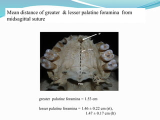 Mean distance of greater & lesser palatine foramina from
midsagittal suture
greater palatine foramina = 1.53 cm
lesser palatine foramina = 1.46 ± 0.22 cm (rt),
1.47 ± 0.17 cm (lt)
 
