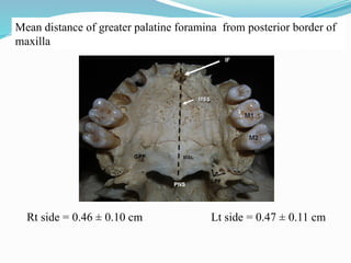 Mean distance of greater palatine foramina from posterior border of
maxilla
Rt side = 0.46 ± 0.10 cm Lt side = 0.47 ± 0.11 cm
 