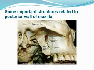 Some important structures related to
posterior wall of maxilla
 