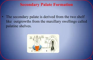 Secondary Palate Formation
• The secondary palate is derived from the two shelf
like outgrowths from the maxillary swellings called
palatine shelves.
43
 