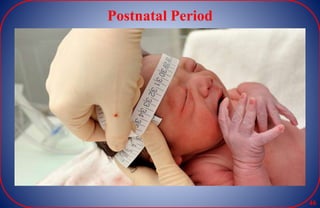 Postnatal Period
46
 