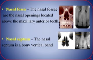 • Nasal fossa – The nasal fossae
are the nasal openings located
above the maxillary anterior teeth.
• Nasal septum – The nasal
septum is a bony vertical band
67
 