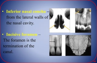 • Inferior nasal concha –
from the lateral walls of
the nasal cavity.
• Incisive foramen –
The foramen is the
termination of the
canal.
68
 