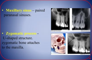 • Maxillary sinus – paired
paranasal sinuses.
• Zygomatic process -
U-shaped structure.
zygomatic bone attaches
to the maxilla.
69
 