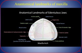 Anantomical landmarks of maxilla
71
 