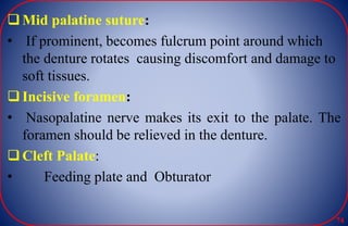 Mid palatine suture:
• If prominent, becomes fulcrum point around which
the denture rotates causing discomfort and damage to
soft tissues.
Incisive foramen:
• Nasopalatine nerve makes its exit to the palate. The
foramen should be relieved in the denture.
Cleft Palate:
• Feeding plate and Obturator
74
 