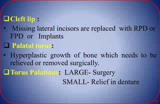 Cleft lip :
• Missing lateral incisors are replaced with RPD or
FPD or Implants
 Palatal torus:
• Hyperplastic growth of bone which needs to be
relieved or removed surgically.
Torus Palatinus: LARGE- Surgery
SMALL- Relief in denture
75
 
