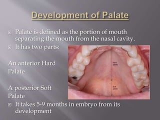  Palate is defined as the portion of mouth
separating the mouth from the nasal cavity.
 It has two parts:
An anterior Hard
Palate
A posterior Soft
Palate
 It takes 5-9 months in embryo from its
development
 