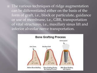  The various techniques of ridge augmentation
can be differentiated either on the basis of the
form of graft, i.e., block or particulate, guidance
or use of membrane, i.e., GBR, transportation
of vital structures, i.e., maxillary sinus lift and
inferior alveolar nerve transportation.
 