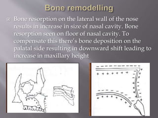  Bone resorption on the lateral wall of the nose
results in increase in size of nasal cavity. Bone
resorption seen on floor of nasal cavity. To
compensate this there’s bone deposition on the
palatal side resulting in downward shift leading to
increase in maxillary height
 