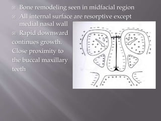  Bone remodeling seen in midfacial region
 All internal surface are resorptive except
medial nasal wall
 Rapid downward
continues growth.
Close proximity to
the buccal maxillary
teeth
 