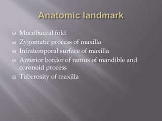  Mucobuccal fold
 Zygomatic process of maxilla
 Infratemporal surface of maxilla
 Anterior border of ramus of mandible and
coronoid process
 Tuberosity of maxilla
 