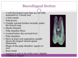 Maxillary 1st premolar | PPTX