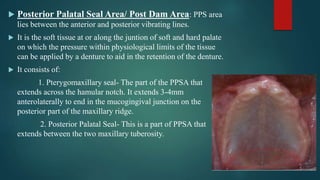  Posterior Palatal Seal Area/ Post Dam Area: PPS area
lies between the anterior and posterior vibrating lines.
 It is the soft tissue at or along the juntion of soft and hard palate
on which the pressure within physiological limits of the tissue
can be applied by a denture to aid in the retention of the denture.
 It consists of:
1. Pterygomaxillary seal- The part of the PPSA that
extends across the hamular notch. It extends 3-4mm
anterolaterally to end in the mucogingival junction on the
posterior part of the maxillary ridge.
2. Posterior Palatal Seal- This is a part of PPSA that
extends between the two maxillary tuberosity.
 