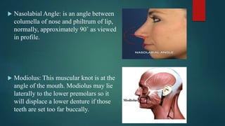  Nasolabial Angle: is an angle between
columella of nose and philtrum of lip,
normally, approximately 90˚ as viewed
in profile.
 Modiolus: This muscular knot is at the
angle of the mouth. Modiolus may lie
laterally to the lower premolars so it
will displace a lower denture if those
teeth are set too far buccally.
 