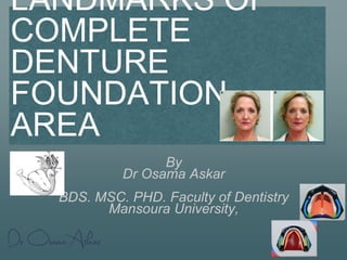 LANDMARKS OF
COMPLETE
DENTURE
FOUNDATION
AREA
By
Dr Osama Askar
BDS. MSC. PHD. Faculty of Dentistry
Mansoura University,
 