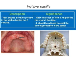Incisive papilla
 