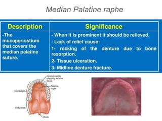 Median Palatine raphe
 