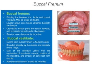 Buccal Frenum
 