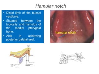 Hamular notch
 