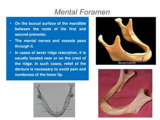Mental Foramen
 