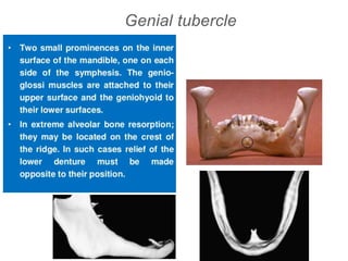 Genial tubercle
 