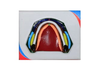 Maxillary and mandibular anatomical land marks