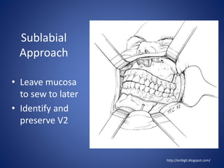 Sublabially Maxillary and periorbital fractures | PPTX
