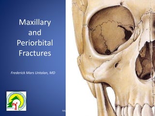 Maxillary
and
Periorbital
Fractures
Frederick Mars Untalan, MD
http://entbgh.blogspot.com/
 