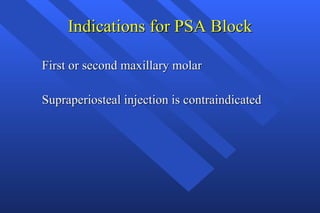 Indications for PSA Block First or second maxillary molar Supraperiosteal injection is contraindicated 