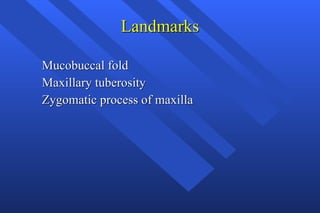 Landmarks Mucobuccal fold Maxillary tuberosity Zygomatic process of maxilla 