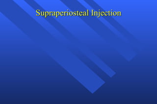 Supraperiosteal Injection 