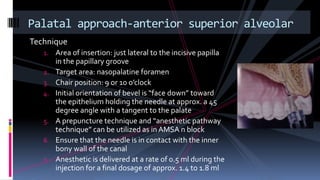 Technique
1. Area of insertion: just lateral to the incisive papilla
in the papillary groove
2. Target area: nasopalatine foramen
3. Chair position: 9 or 10 o’clock
4. Initial orientation of bevel is “face down” toward
the epithelium holding the needle at approx. a 45
degree angle with a tangent to the palate
5. A prepuncture technique and “anesthetic pathway
technique” can be utilized as in AMSA n block
6. Ensure that the needle is in contact with the inner
bony wall of the canal
7. Anesthetic is delivered at a rate of 0.5 ml during the
injection for a final dosage of approx. 1.4 to 1.8 ml
Palatal approach-anterior superior alveolar
 