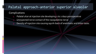 Complications
1. Palatal ulcer at injection site developing 1 to 2 days postoperative
2. Unexpected nerve contact of the nasopalatine nerve
3. Density of injection site causing squirk-back of anesthetic and bitter taste.
Palatal approach-anterior superior alveolar
 