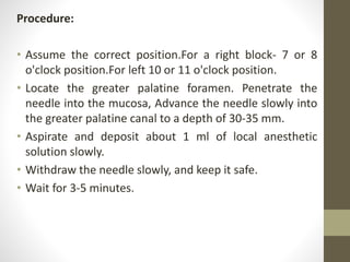Procedure:
• Assume the correct position.For a right block- 7 or 8
o'clock position.For left 10 or 11 o'clock position.
• Locate the greater palatine foramen. Penetrate the
needle into the mucosa, Advance the needle slowly into
the greater palatine canal to a depth of 30-35 mm.
• Aspirate and deposit about 1 ml of local anesthetic
solution slowly.
• Withdraw the needle slowly, and keep it safe.
• Wait for 3-5 minutes.
 