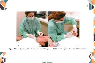 Maxillary anesthesia techniques | PDF