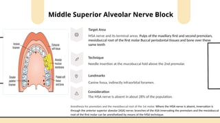techniques of maxillary local anesthesia | PPTX