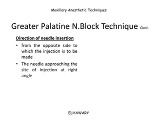 Np Injection Anesthetic techniques - Maxillary anesthetic techniques | PDF