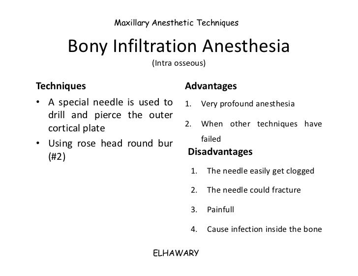 Maxillary Anesthesia Techniques