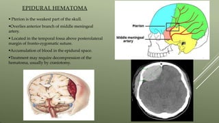 EPIDURAL HEMATOMA
 Pterion is the weakest part of the skull.
Overlies anterior branch of middle meningeal
artery.
 Located in the temporal fossa above posterolateral
margin of fronto-zygomatic suture.
Accumulation of blood in the epidural space.
Treatment may require decompression of the
hematoma, usually by craniotomy.
 